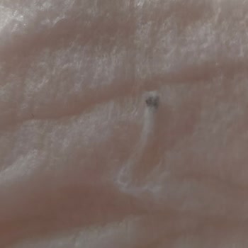 Bebek Bezinde Taş Benzeri Sert Cisimle Karşılaşmak Güvenimi Sarsıyor