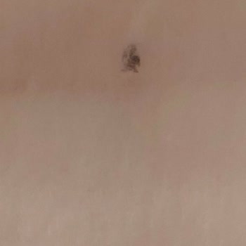 Bebek Bezinde Taş Benzeri Sert Cisimle Karşılaşmak Güvenimi Sarsıyor