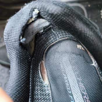 Kısa Sürede Deforme Olan Skechers Ayakkabı Ve Yetersiz İnceleme Sonucu