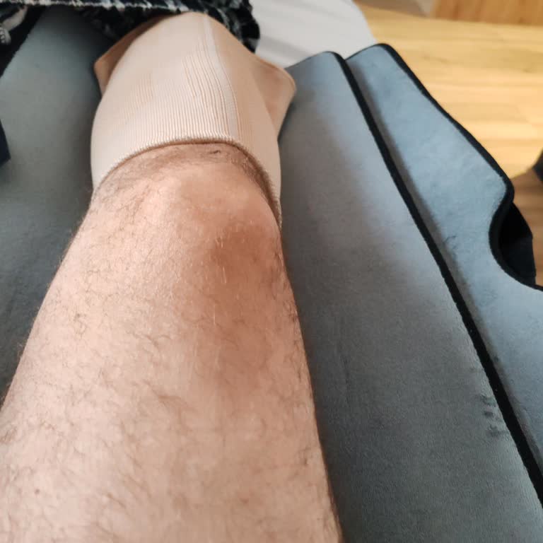 Yurt Dışında Sakatlandım, Anadolu Sigorta Destek Olmadı