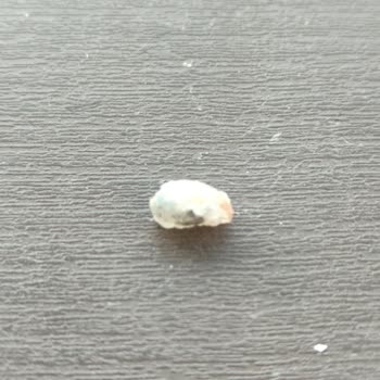 Çocuklarımın Yediği Çikolatadan Yabancı Cisim Çıktı, Gıda Güvenliği Tehlikede!