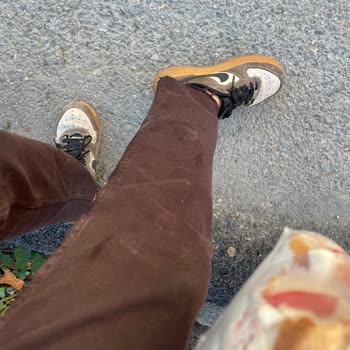 Martı Elektrikli Bisikletin Fren Arızası Nedeniyle Yaşanan Ciddi Kaza Ve Yaralanma