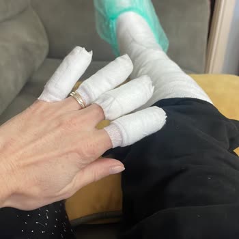 Martı Elektrikli Bisikletin Fren Arızası Nedeniyle Yaşanan Ciddi Kaza Ve Yaralanma