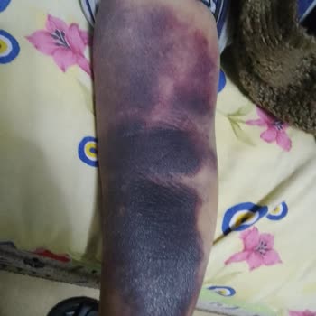 Ağır Hasta Anneme Acil Serviste Yetersiz Ve Dikkatsiz Müdahale