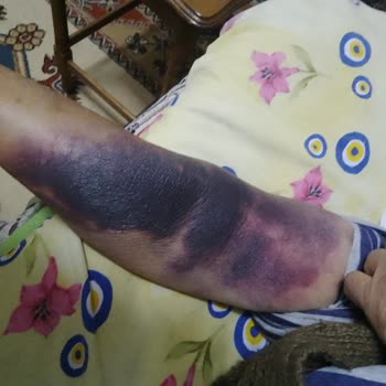 Ağır Hasta Anneme Acil Serviste Yetersiz Ve Dikkatsiz Müdahale