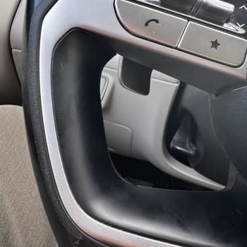 Hyundai Tucson Direksiyonunda Beklenmedik Deformasyon Ve Garanti Talebi