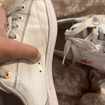 Kısa Sürede Deforme Olan Ayakkabı Ve Tekrarlayan Mağduriyet