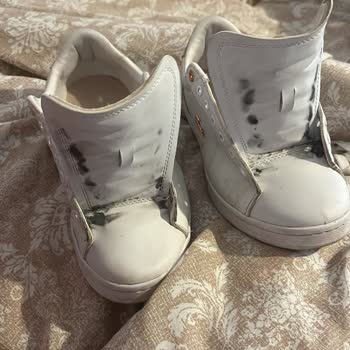 Kısa Sürede Deforme Olan Ayakkabı Ve Tekrarlayan Mağduriyet