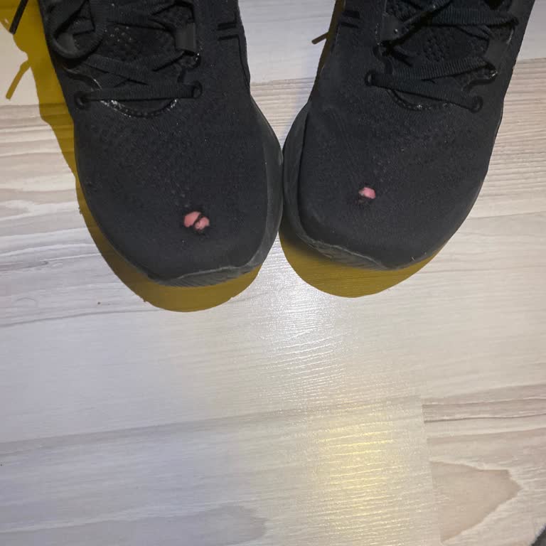 Kısa Sürede Deforme Olan Ayakkabı İçin Destek Talebime Olumsuz Yanıt Verildi