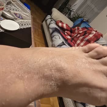 Sağlığımı Tehdit Eden Bot Ve Satıcı İlgisizliği Nedeniyle Mağduriyet