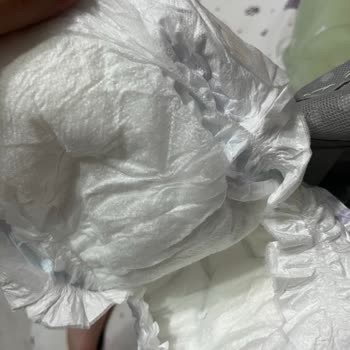 Molfix 5 Numara Bezde Sızdırma Ve Cilt Sorunları Yaşadım