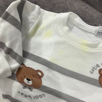 Bebek Mamasında Anormal Koku Ve Sağlık Sorunları Yaşadım