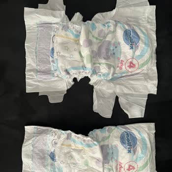 Molfix Bebek Bezlerinde Sürekli Tekrarlayan Defolu Ürün Sorunu