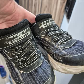 Kısa Sürede Deforme Olan Ayakkabıya Ret Cevabı Şaşkınlığı