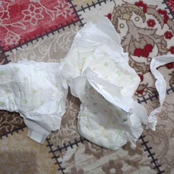 Baby Turco 4 Numara Çocuk Bezlerinde Tekrarlayan Kalite Sorunu