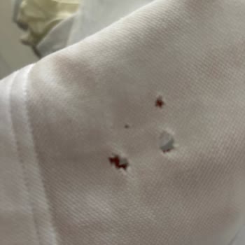 Çamaşır Makinesi Giysilerimi Deliyor Ve Gürültülü Çalışıyor, Sorun Giderilmiyor