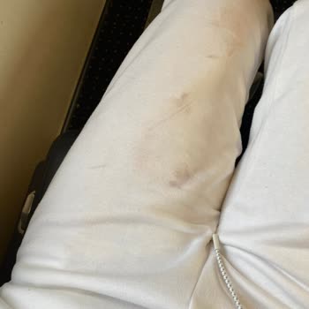 Aldığım Çanta Kısa Sürede Bozuldu, Kıyafetime Zarar Verdi