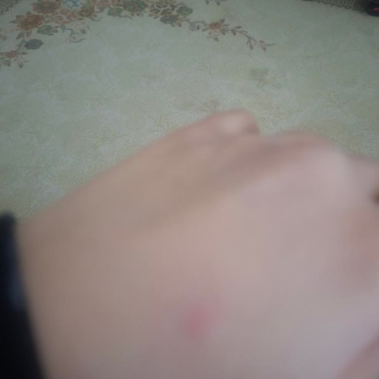 Atoderm Krem Alerji Yaptı, Mağdur Oldum