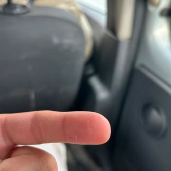 Gratis Kırık Ürün Teslimatı Ve Sürekli Yaşanan Sipariş Sorunları Nedeniyle Büyük Mağduriyet