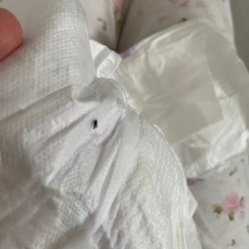 Bebek Bezinde Ahşap Kıymık: Güven Sarsıcı Ve Tehlikeli Üretim Hatası