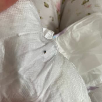 Bebek Bezinde Ahşap Kıymık: Güven Sarsıcı Ve Tehlikeli Üretim Hatası