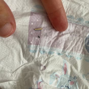 Bebek Bezinde Ahşap Kıymık: Güven Sarsıcı Ve Tehlikeli Üretim Hatası