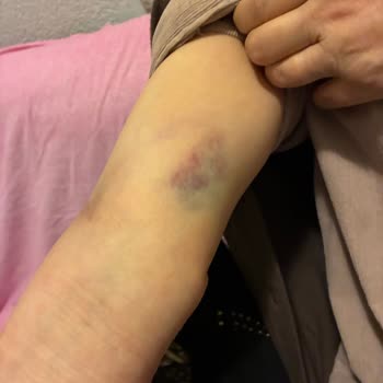 Dr. Murat Ünlü Anjiyo Sonrası Yaşadığım Ciddi Sağlık Sorunları Ve Hayal Kırıklığı