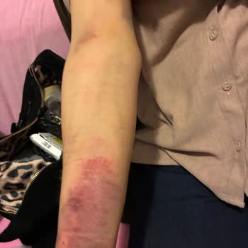 Dr. Murat Ünlü Anjiyo Sonrası Yaşadığım Ciddi Sağlık Sorunları Ve Hayal Kırıklığı