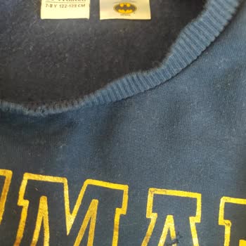 Yanık Gelen Çocuk Kazağına İlgisiz Kalan Müşteri Hizmeti