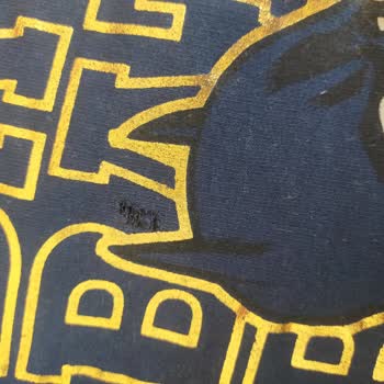 Yanık Gelen Çocuk Kazağına İlgisiz Kalan Müşteri Hizmeti