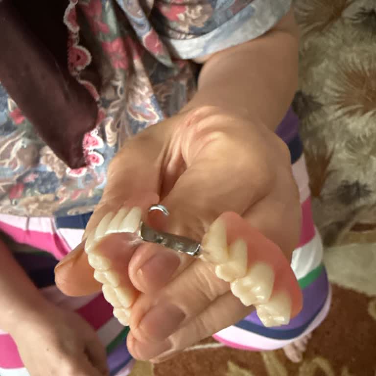 Protez Tedavisinde Uzayan Süre Ve Devam Eden Sorunlar