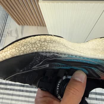 Kısa Sürede Yıpranan Ayakkabıya Yetersiz İnceleme Ve Ret Kararı