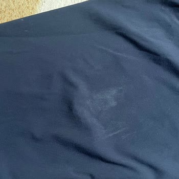 Yeni Aldığım Pantolon Ütüyle Anında Yandı Kullanıcı Hatası Dediler