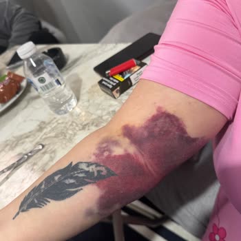 Ameliyat Sonrası Hemşirelerin Yetersizliği Ve İlgisizliği Nedeniyle Mağduriyet