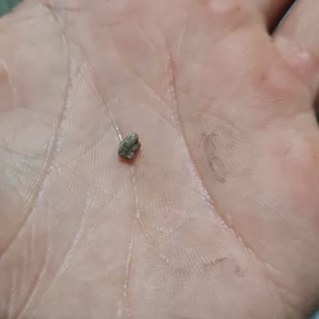 Siparişimde Taş Çıkması Ve Müşteri Hizmetlerine Ulaşamama Sorunu