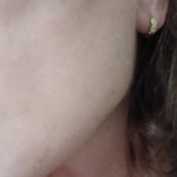 Bioderma Sébium Sensitive Kremde Formül Değişikliği Veya Ürün Sorunu