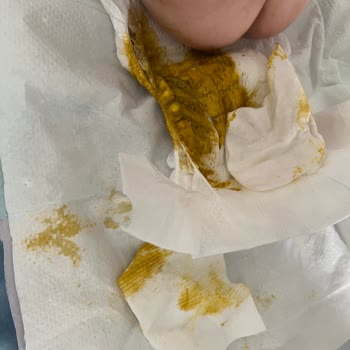 Prima Premium Care Bebek Bezinde Sürekli Sızdırma Ve Mağduriyet Yaşıyorum!