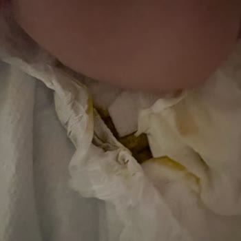 Prima Premium Care Bebek Bezinde Sürekli Sızdırma Ve Mağduriyet Yaşıyorum!