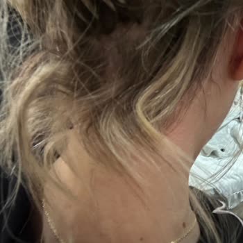 Kuaförde Saçlarım Yandı, Kalitesiz Kaynak Ve İlgisiz Tavırlarla Mağdur Edildim