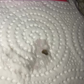 Dr. Oetker Pudding Contamination: Black Object Found Inside Product