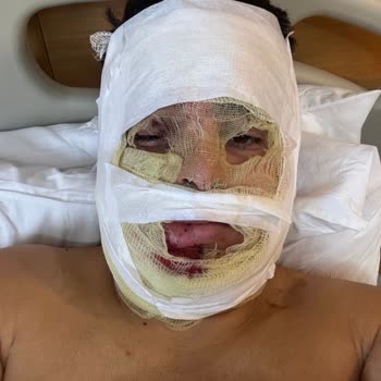 İki Yıldır Ödenmeyen Tazminat Nedeniyle Yaşadığım Mağduriyet