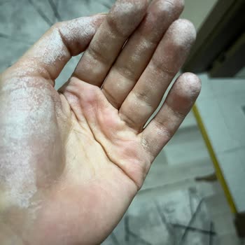 Domol Leke Çıkarıcı Sprey Elde Ciddi Yanma Yaptı