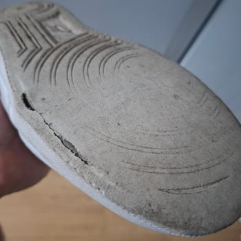 1,5 Ayda Tabanı Açılan Ayakkabı İçin Red Kararı Şaşkınlığı