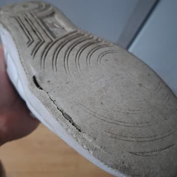 1,5 Ayda Tabanı Açılan Ayakkabı İçin Red Kararı Şaşkınlığı