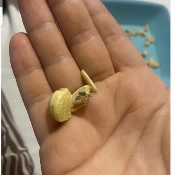 Karışık Kuruyemişte Kurt Çıkması Çocuğumun Sağlığını Riske Attı