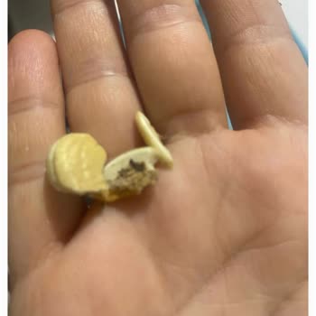 Karışık Kuruyemişte Kurt Çıkması Çocuğumun Sağlığını Riske Attı