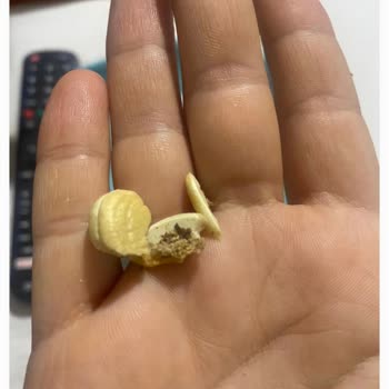 Karışık Kuruyemişte Kurt Çıkması Çocuğumun Sağlığını Riske Attı