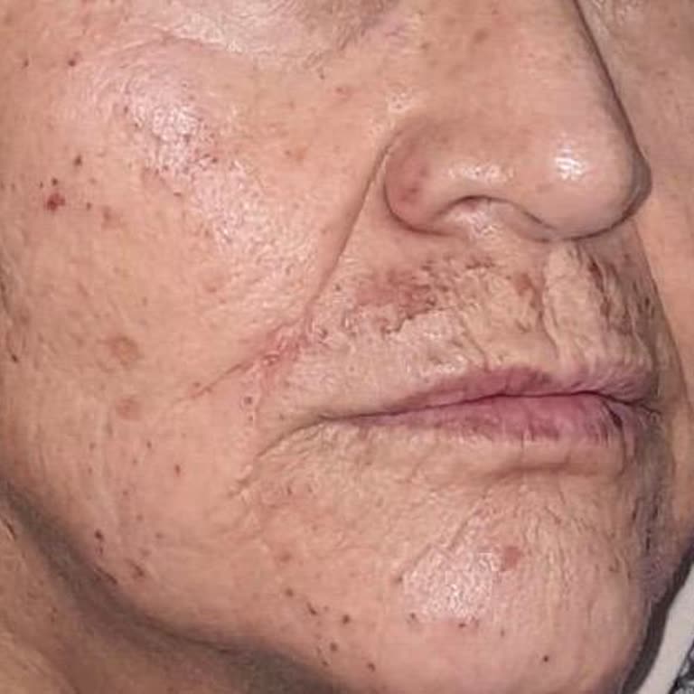 Cilt Bakımında Memnuniyetsizlik Ve Beklenmeyen Cilt Sorunları