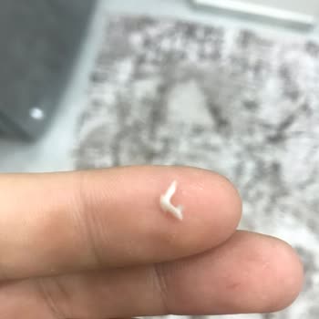 Ton Balığında Yabancı Parça Çıktı Dardanelden Açıklama Bekliyorum