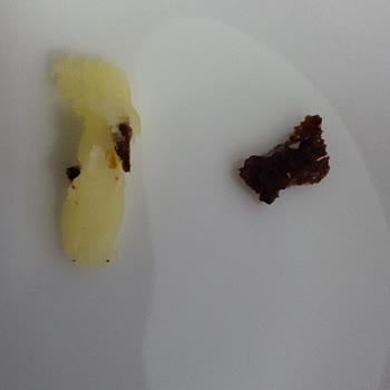 Muratbey Kaşar Peynirinde Yabancı Madde Şoku: Gıda Güvenliği Endişesi